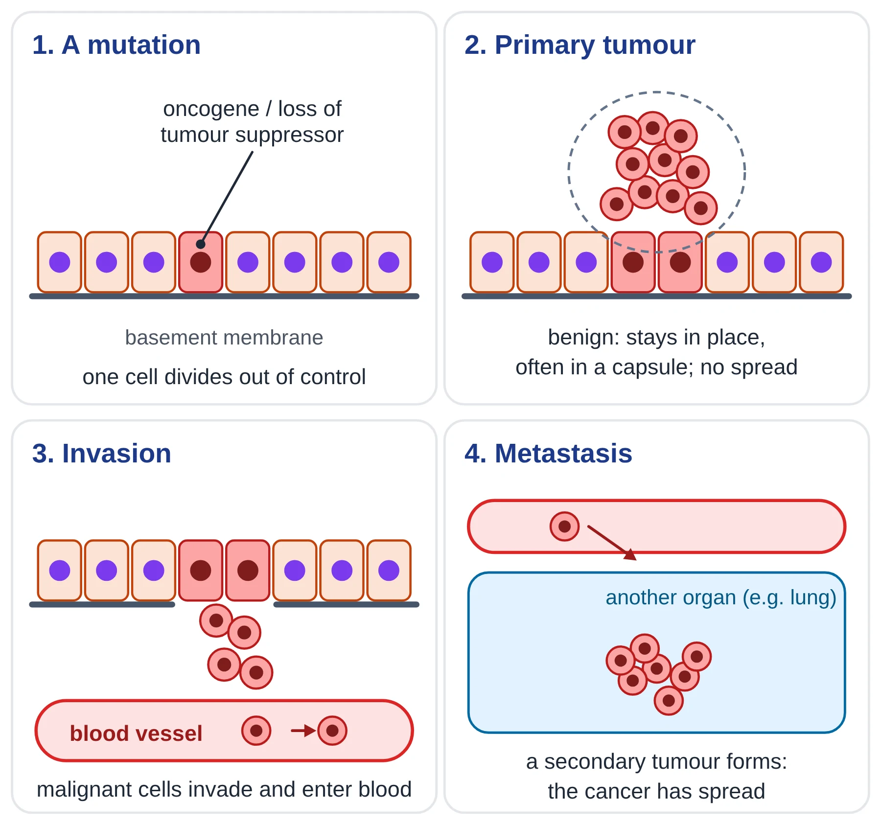 Cell cycle: four panels showing a mutated epithelial cell, a primary tumour, malignant cells invading through the basement membrane into a blood vessel, and a secondary tumour in another organ